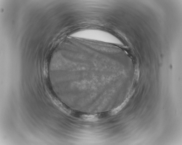 X0000087420170200705111925