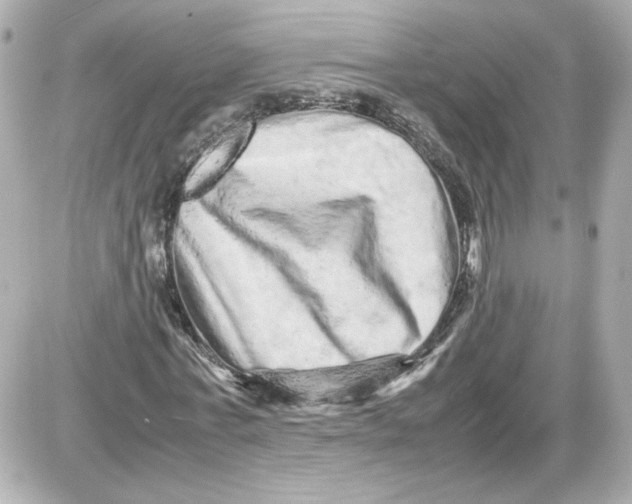 X0000087420771200705111915