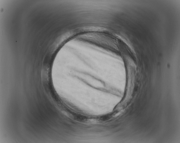 X0000087420111200705181432