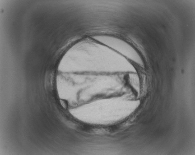 X0000087420115200705181432