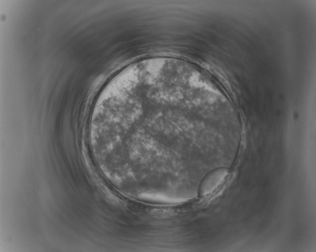 X0000087420145200705181431