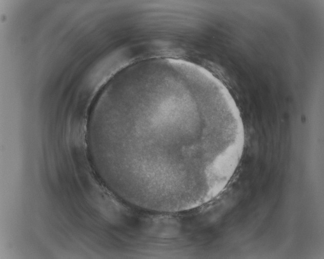 X0000087420146200705181431