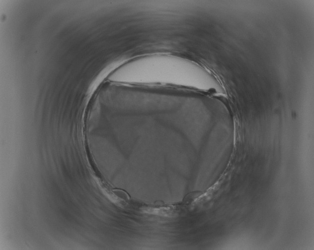 X0000087420147200705181431