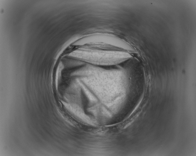 X0000087420148200705181431