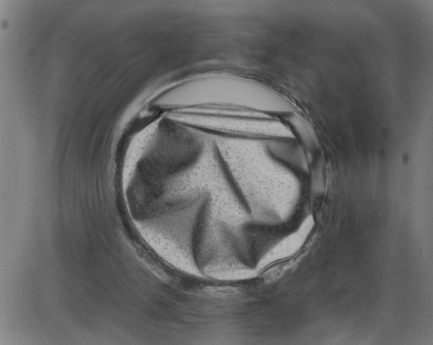 X0000087420150200705181431