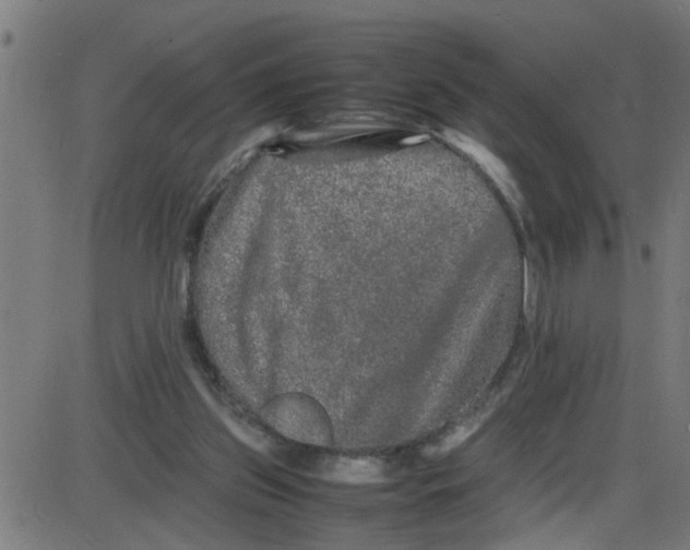 X0000087420157200705181431