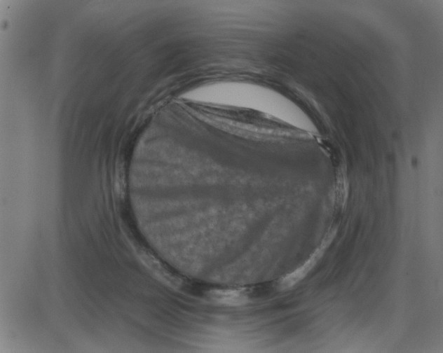 X0000087420170200705181431
