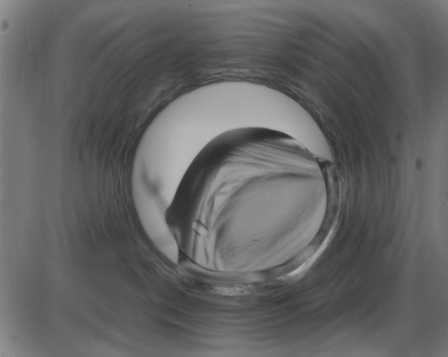 X0000087420190200705181432