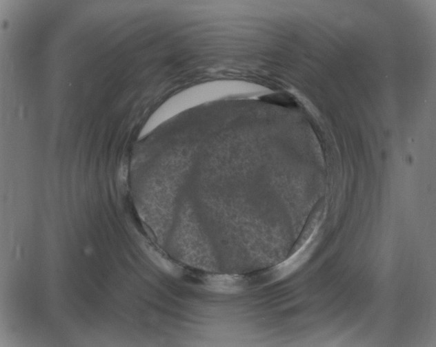 X0000087420192200705181432