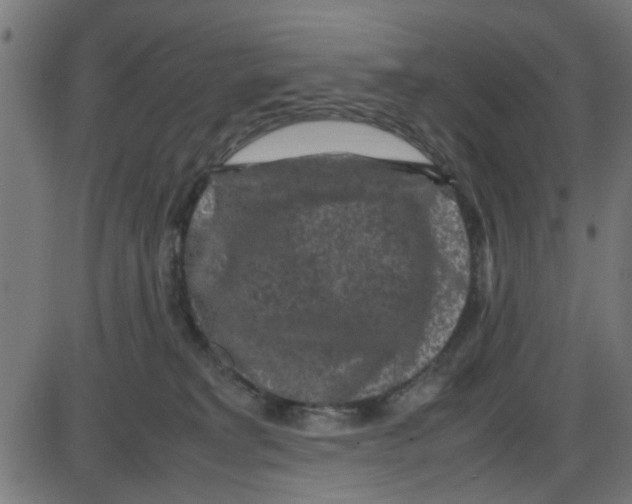 X0000087420229200705181430