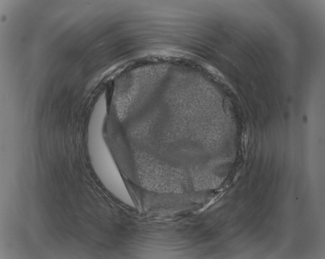 X0000087420822200705181420