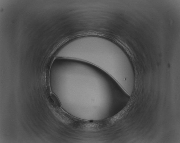 X0000087510158200704270802