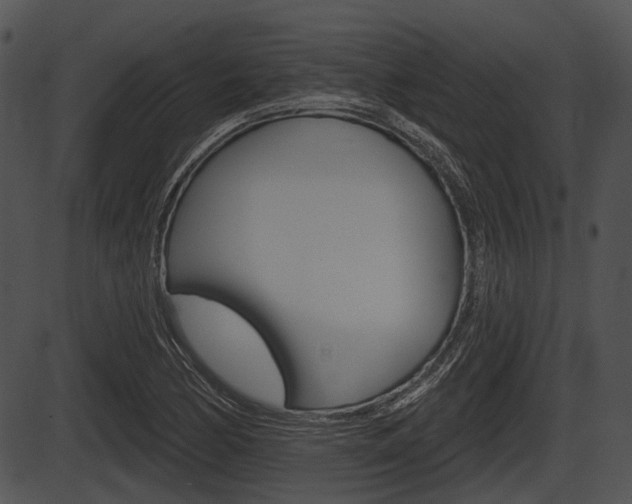 X0000087511170200704270746