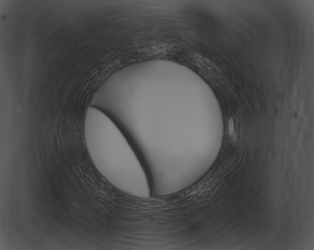 X0000087511203200704270745