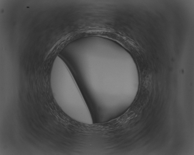 X0000087511351200704270743
