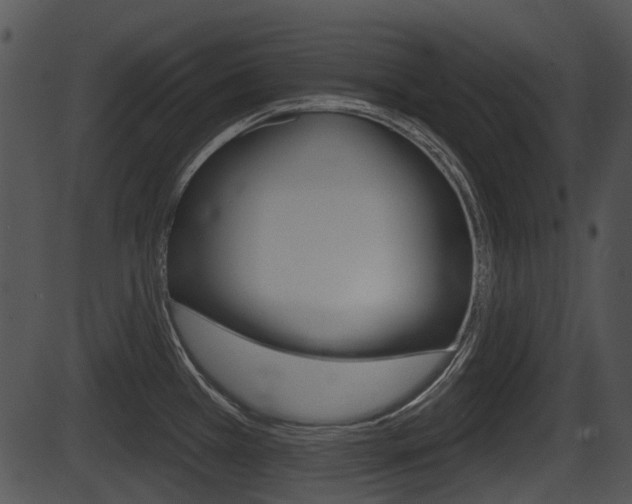 X0000087511385200704270743
