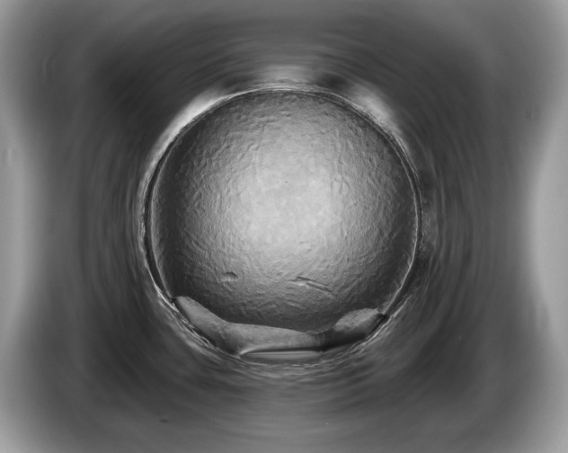 X0000087511435200704271115