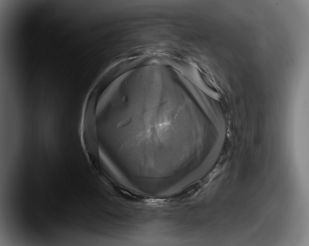 X0000087510052200705181001