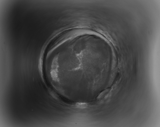 X0000087510055200705181001