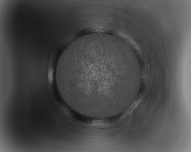 X0000087510070200705181002