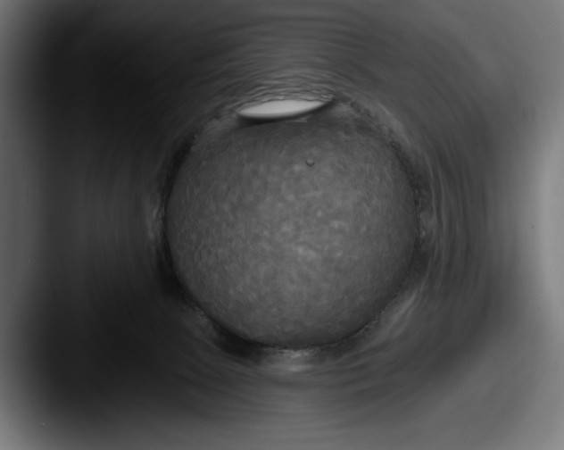 X0000087510081200705181002