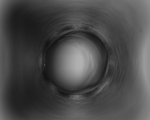 X0000087510139200705181001