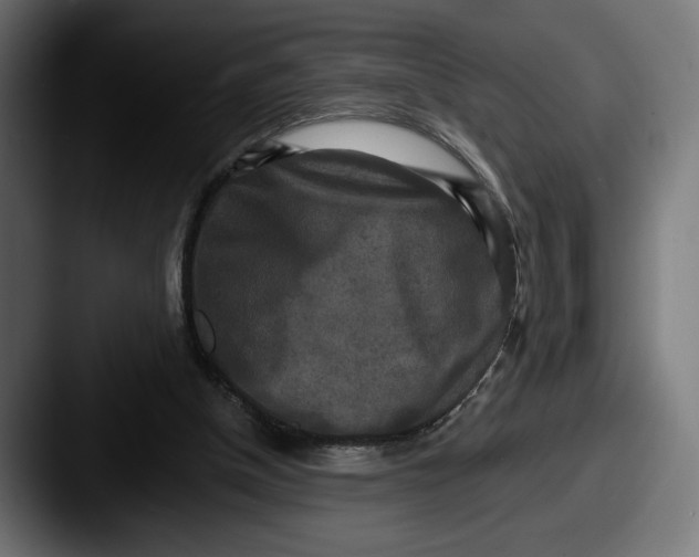 X0000087510154200705181000