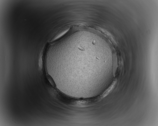 X0000087510158200705181000