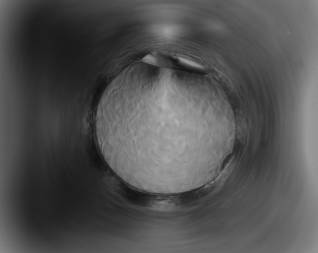 X0000087510175200705181001