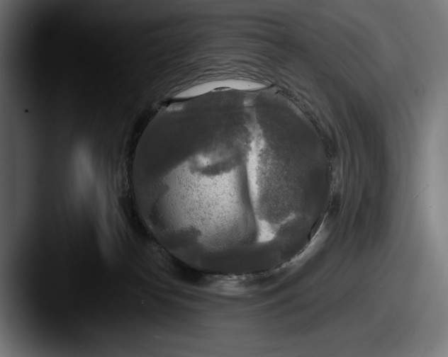 X0000087510182200705181001