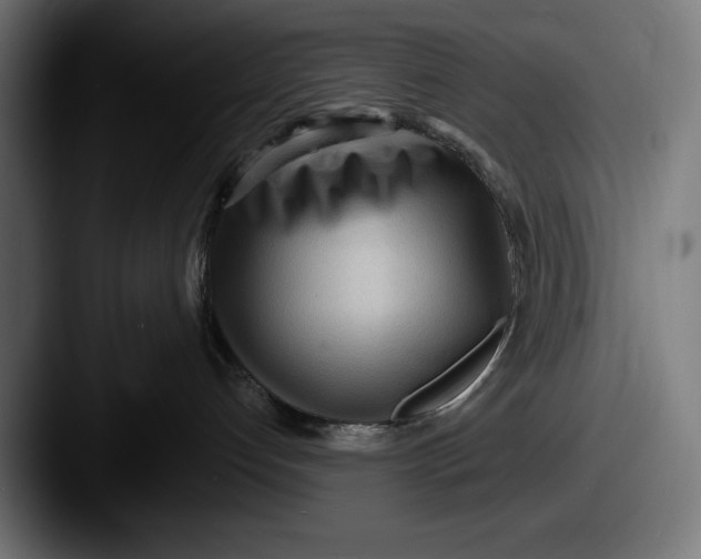 X0000087510192200705181001