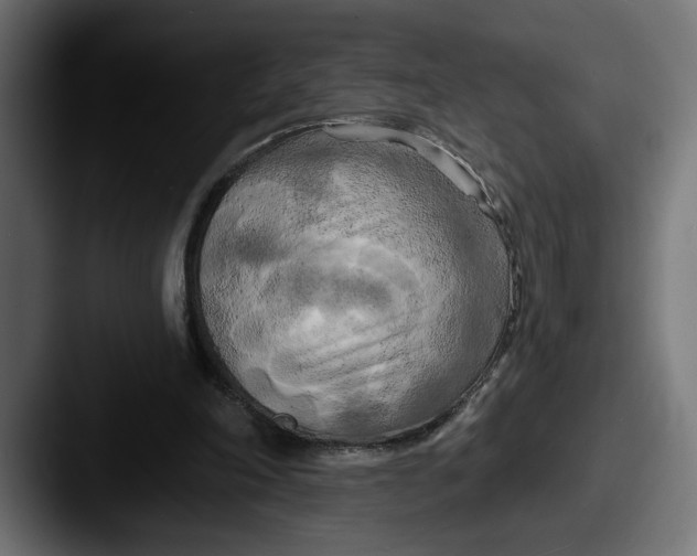 X0000087510198200705181000