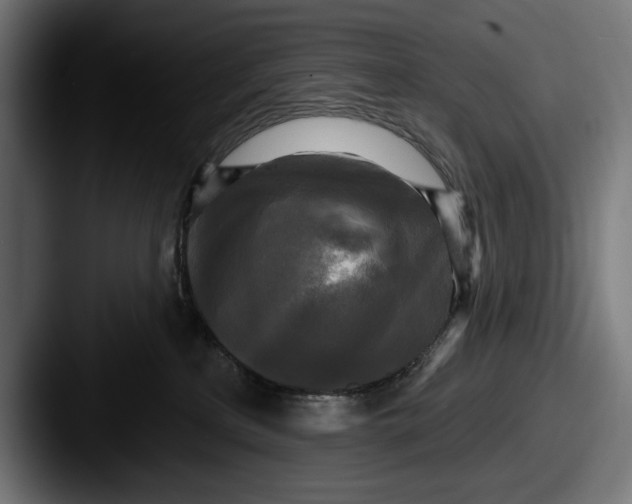 X0000087510233200705181000