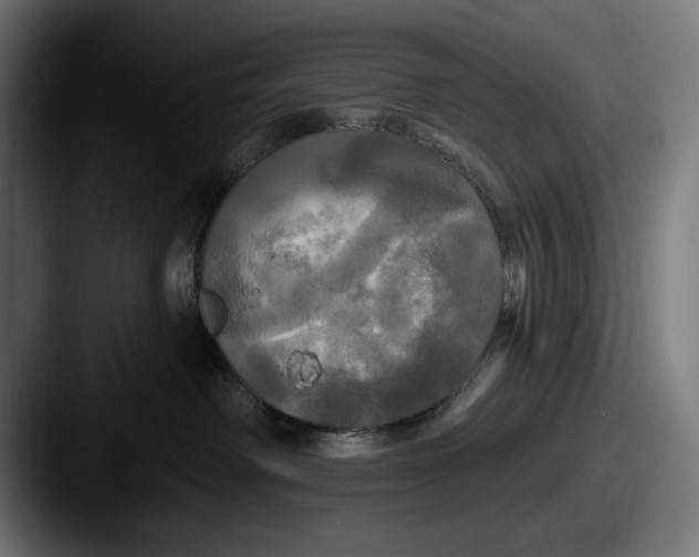 X0000087510238200705181000