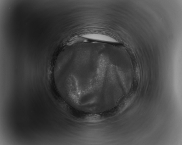 X0000087510271200705181000