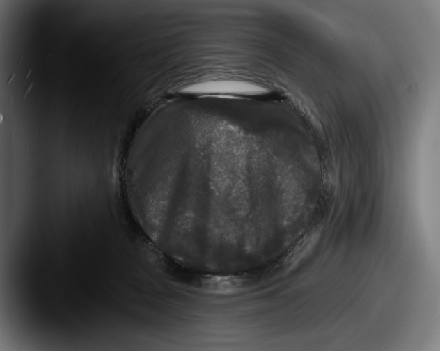 X0000087510277200705181000