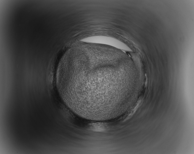 X0000087510417200705180958