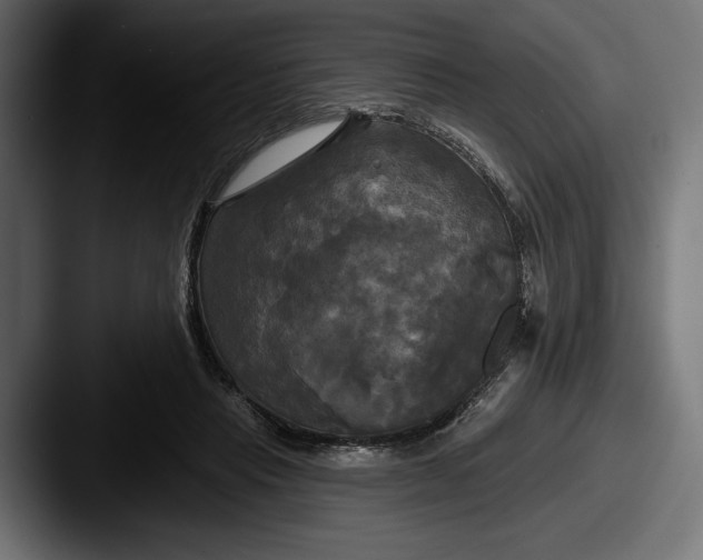X0000087510453200705180957