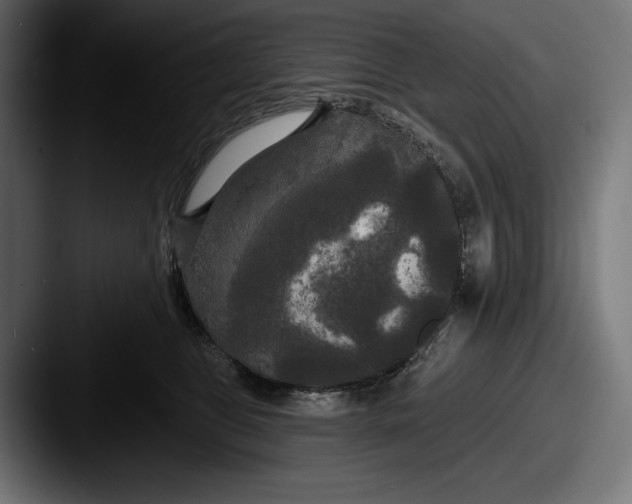 X0000087510469200705180957