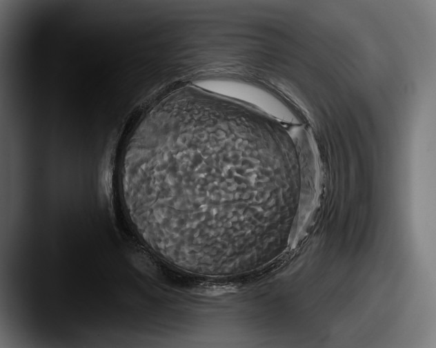 X0000087510491200705180957