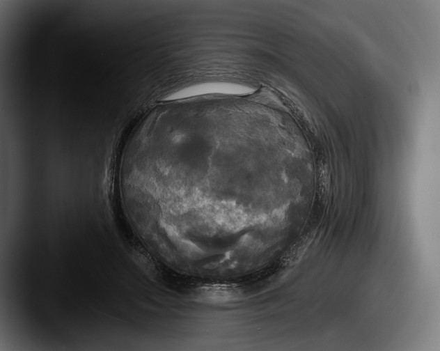 X0000087510499200705180957