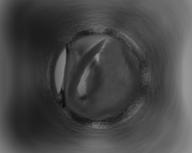 X0000087510641200705180955