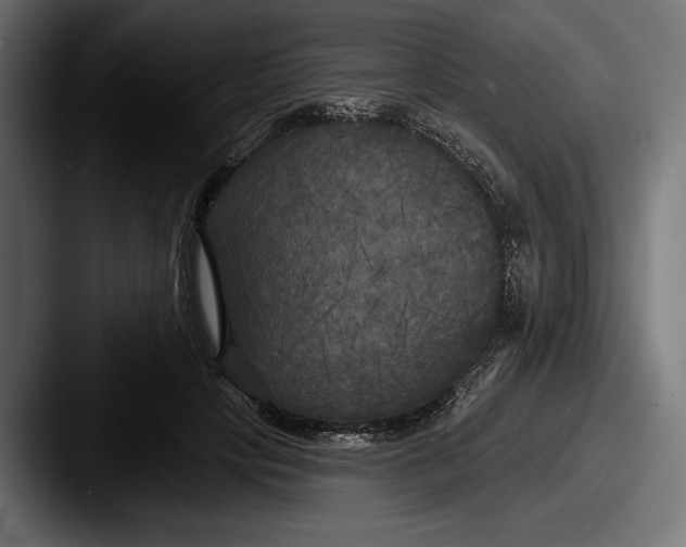 X0000087510649200705180955