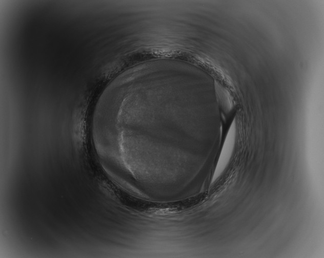 X0000087510689200705180955