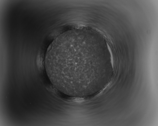 X0000087510719200705180954