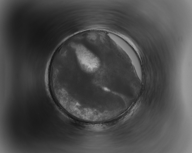 X0000087510999200705180951