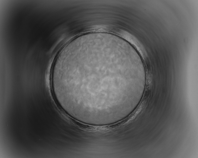 X0000087511090200705180950