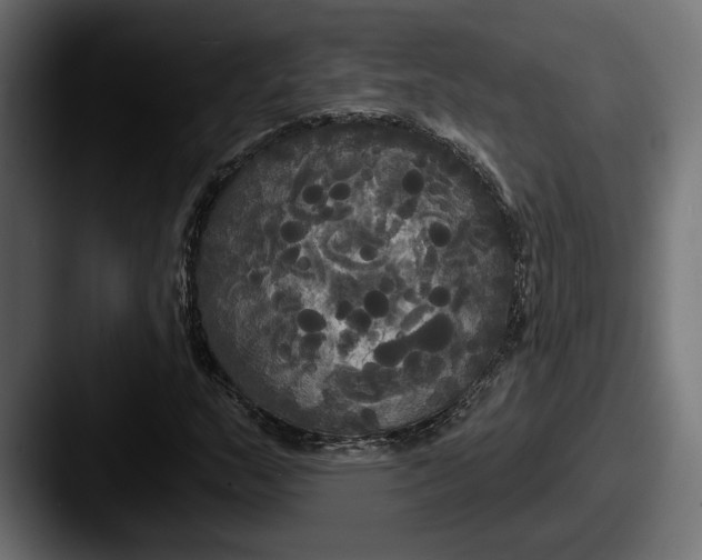 X0000087511159200705180949