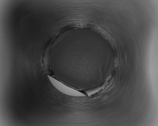 X0000087511202200705180948