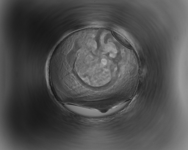X0000087511243200705180949